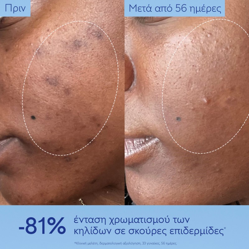 Caudalie Vinoperfect Brightening Dark Spot Serum Ορός Προσώπου Λάμψης για Πανάδες & Κηλίδες 50ml