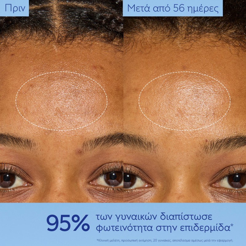 Caudalie Vinoperfect Dark Spot Niacinamide Moisturizer Hμέρας Κρέμα Προσώπου κατά των Κηλίδων για Λάμψη & Ενυδάτωση 50ml