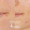 Caudalie Vinopure Salicylic Spot Solution (15ml)