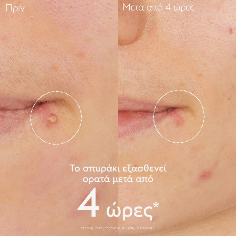 Caudalie Vinopure Salicylic Spot Solution (15ml)