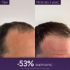 Caudalie Anti-Hair Loss Serum (50ml)