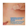 Cerave Blemish Barrier Patches x 22       